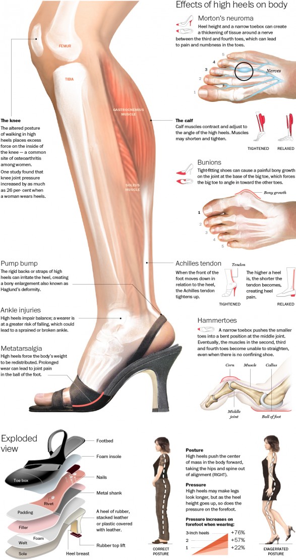 Do women wear high heels casually daily, and why do they do it? - Quora